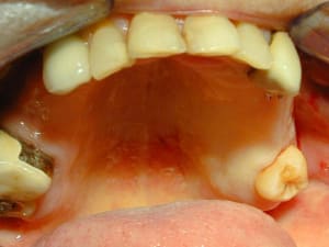 Début ztkxfi - Eugenol