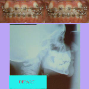 Depart ol6hkq - Eugenol