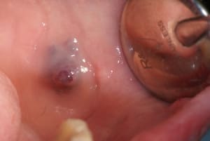 Dsc00052 ttcbtz - Eugenol