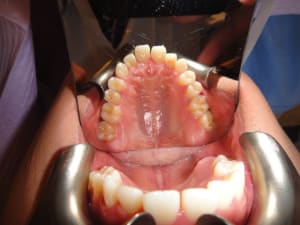 Dsc00868 g4hdz6 - Eugenol