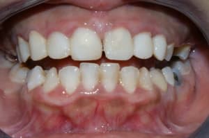 Dsc03357 xnqxdz - Eugenol