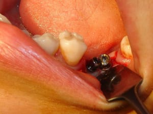 Dsc03462 ek8mqq - Eugenol