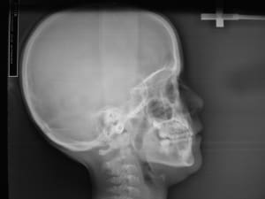 Dscf0017 igg0so - Eugenol