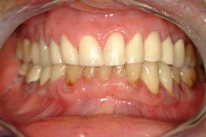 Dscf0033 xgfphi - Eugenol