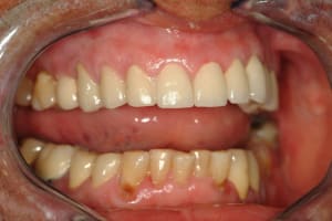 Dscf0070 odzx5v - Eugenol