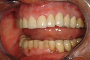 Dscf0071 ky6vhn - Eugenol