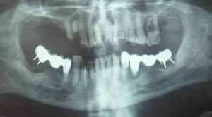 Dscf0823  2  yhstnh - Eugenol