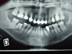 Dscf1272  2  hvk8cw - Eugenol
