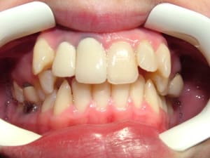 Dscf2444 xulxea - Eugenol