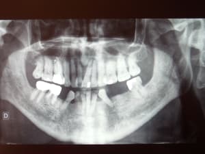 Dscf2555 2 pvbfvi - Eugenol