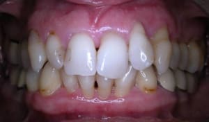Dscn0013 yxr0zr - Eugenol
