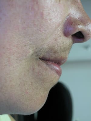 Dscn0443 io48z8 - Eugenol