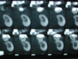 Dscn1325 lqirx1 - Eugenol