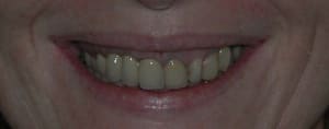 Dscn1327 copie crz9xk - Eugenol