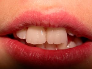 Dscn1391 hvxvad - Eugenol