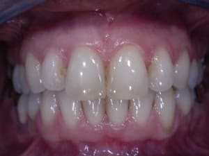 Dscn1764 qa9to3 - Eugenol