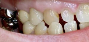 Dscn2336w ldtxjh - Eugenol