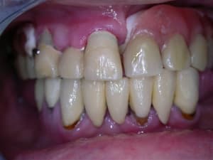 Dscn2598 pqlbuh - Eugenol