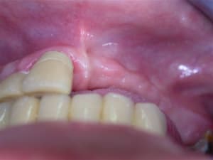 Dscn2606 lrjcmt - Eugenol