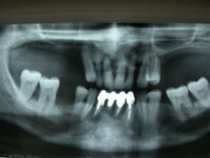 Dscn2704 mzbvno - Eugenol