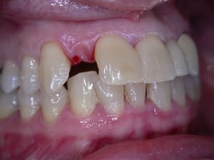Dscn2886 uaroim - Eugenol