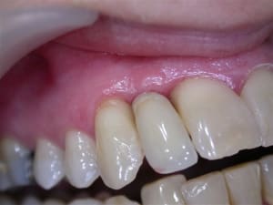 Dscn3234 kuuiqf - Eugenol