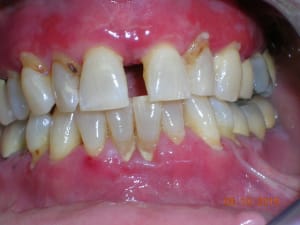 Dscn5177 kmfijc - Eugenol