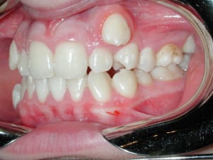 Dscn7795 s3iacv - Eugenol