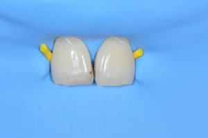 Dsc 0008 n3fsl7 - Eugenol