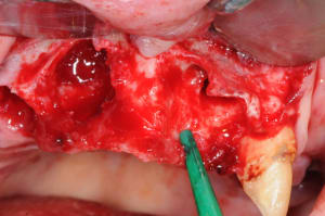 Dsc 0029 ezk4eb - Eugenol