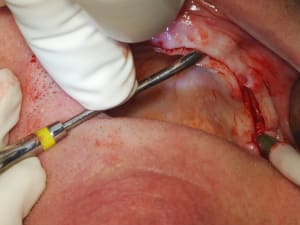 Dsc 0031 nki9qq - Eugenol