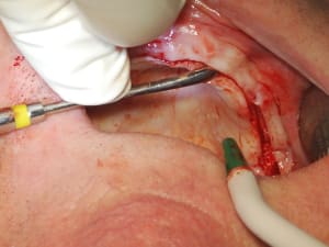 Dsc 0033 gn4zo0 - Eugenol