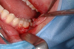 Dsc 0035 bmwky7 - Eugenol