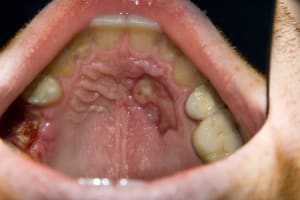 Dsc 0039 gyodgn - Eugenol