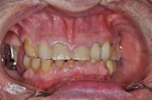 Dsc 0043 f0mqxw - Eugenol
