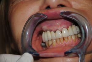Dsc 0066 x9kbaz - Eugenol