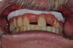 Dsc 0070 f4ow5y - Eugenol