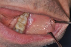 Dsc 0073 b694wd - Eugenol