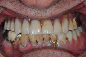 Dsc 0075 ceum0t - Eugenol