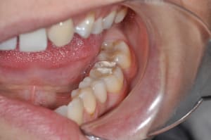 Dsc 0076 yxswd3 - Eugenol