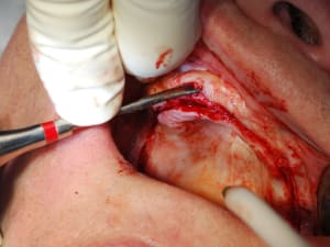 Dsc 0091 kjfpbl - Eugenol