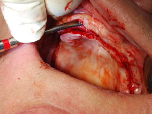 Dsc 0092 uyvco0 - Eugenol