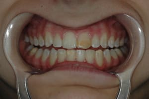 Dsc 0122 qu7egn - Eugenol