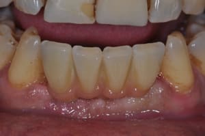 Dsc 0230 k4kzvs - Eugenol