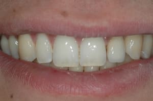 Dsc 0322 xxveb9 - Eugenol