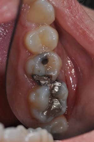 Dsc 0558 j3h3sa - Eugenol