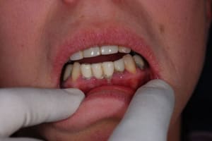 Dsc 0735  800x600  sgv9at - Eugenol