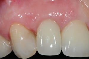 Dsc 1534 cpci6i - Eugenol