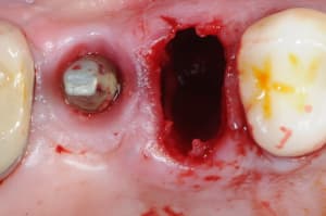 Dsc 1546 mm30ck - Eugenol