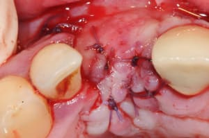 Dsc 1676 wzsqrx - Eugenol